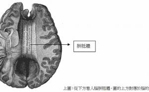 认识胼胝体 - 内蒙古心理网