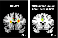 科学家通过大脑影像判断你是否遇到真爱